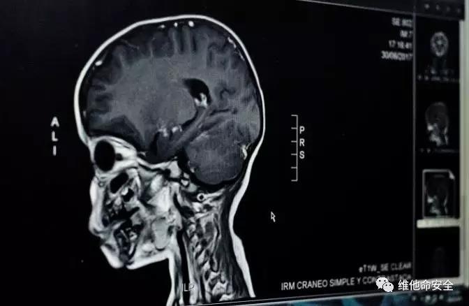 �������ǲ�-������ʱ�й�����